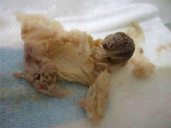 花根球纯中药温宫驱寒